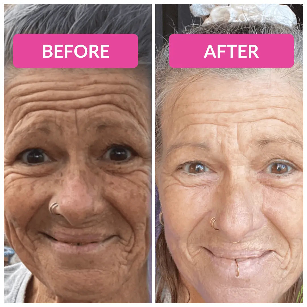 Vibriance Super C Serum
