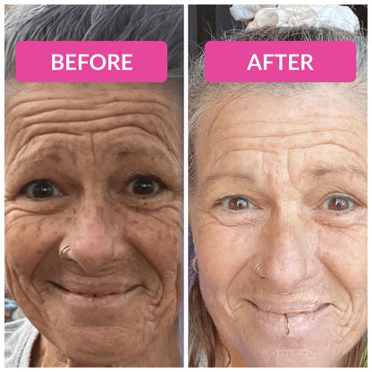 Vibriance Super C Serum