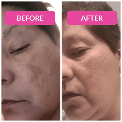 Vibriance Super C Serum